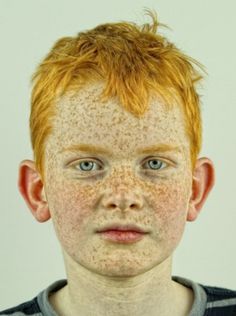 tumblr_llcw8du46I1qza249o1_400.jpg 400×536 pixels #boy #potrait #freckles