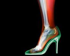 Des vêtements passés aux rayons X par Nick Veasey #woman #foot #shoe #ray #heel #bones
