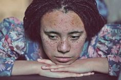 Zuzu Valla Captures The Beauty of Freckles With Striking Portraits
