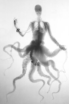 Bonichi Benedetta - X-Ray Photography #white #horror #black #octopus #necklace #tentacles #ray #photography #sea #x #and #monster