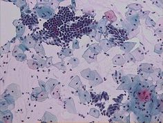 File:Pap test wnl .jpg - Wikipedia #photography #colors #science #test