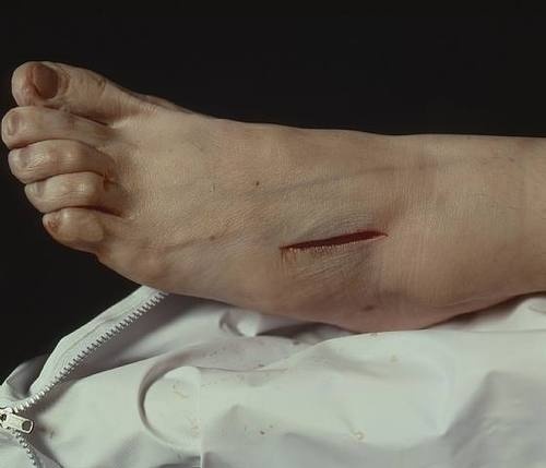 Andres Serrano, The Morgue (Rat Poison Suicide II), 1992 #foot #morgue #realism #figure #renaissance