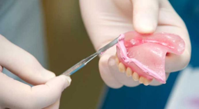 Denture reline is the procedure the dentist uses to make your partial or full dentures to fit your gums properly again. There are different types of dentures reline: with hard or soft reline materials. The denture reline cost is relatively affordable