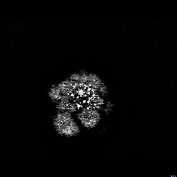MRI broccoli Imgur #circle #mri #broccoli