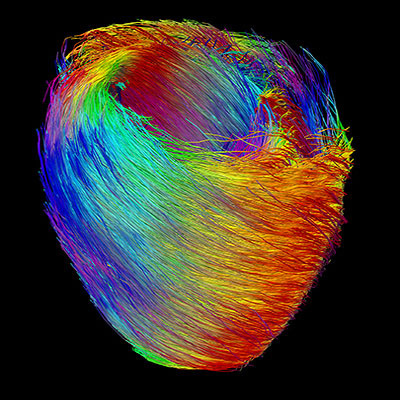 Heart Fibers