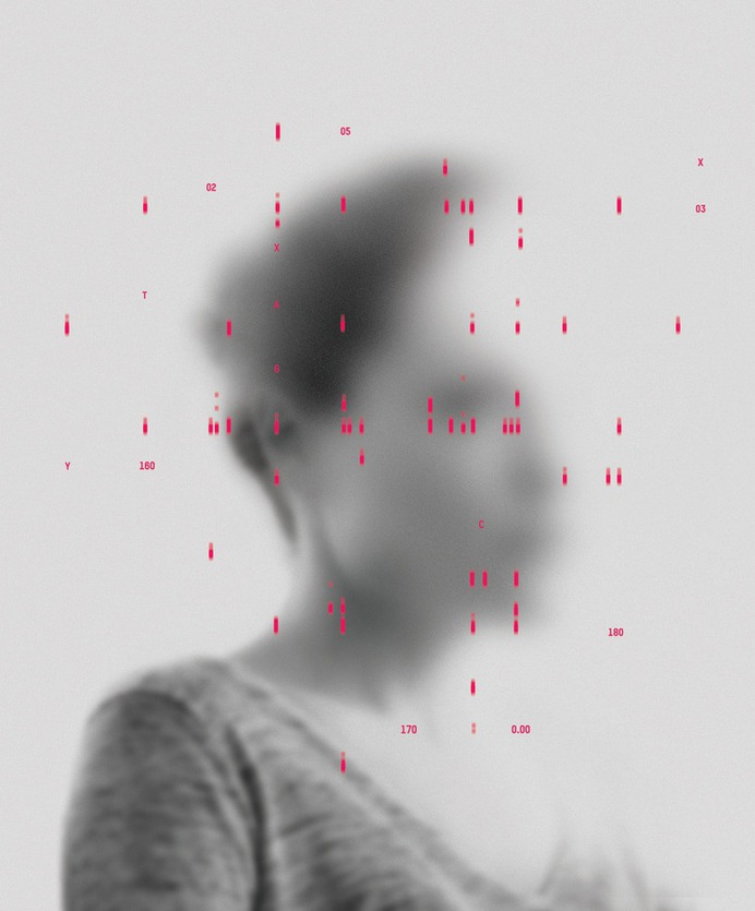 NYT Sunday Review – Alzheimer's Prediction
