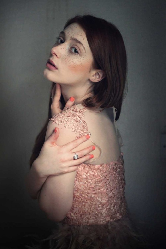 Zuzu Valla Captures The Beauty of Freckles With Striking Portraits