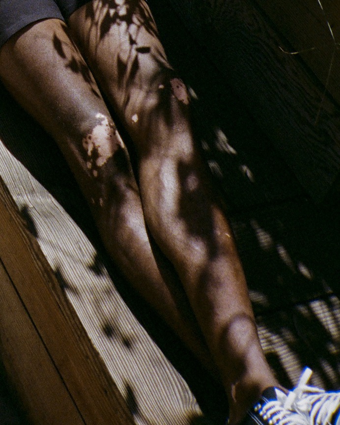 shadows