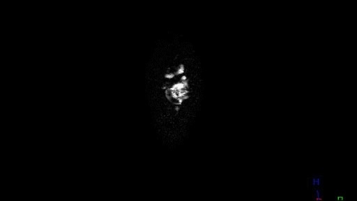 PINAPPLE Magnetic Resonance Imaging uses magnets to align hydrogen atoms and radio waves to create a series of images of internal structures #andy #elisson #magnetic #mri #3d