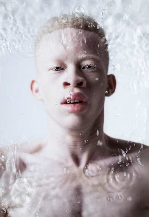 Sanele Xaba Tumblr Model Drowning Water Albino Photography Portrait Search By Muzli