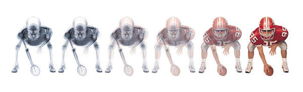 X-Rays #football #sports #xrays