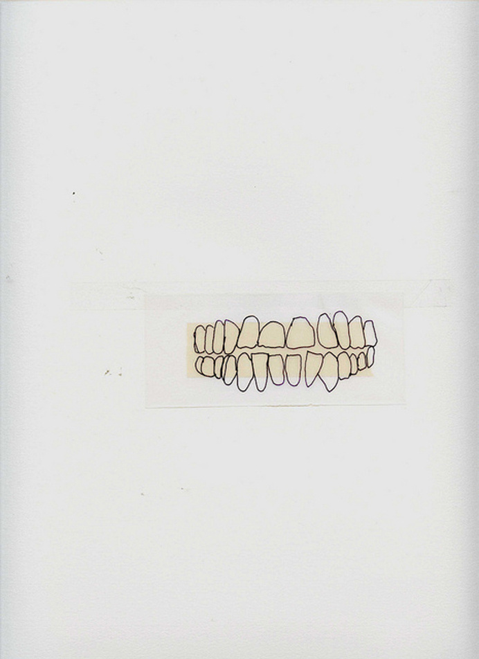 Ximena Forero M. #teeth #illustration