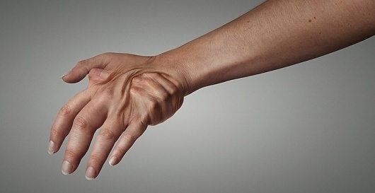 Human Metamorphosis (15 pics) - My Modern Metropolis #anatomy #metamorphosis