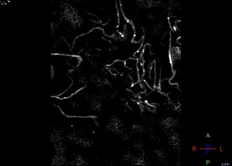 LETTUCE MRI Scans of Produce are Completely Amazing | IFLScience Magnetic Resonance Imaging uses magnets to align hydrogen atoms and radio #andy #elisson #magnetic #lettuce #mri #3d