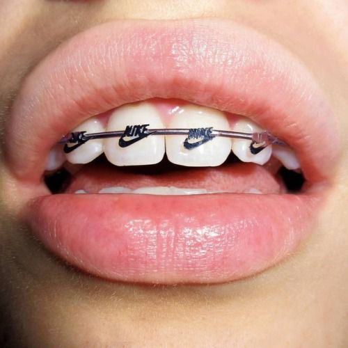 nike braces