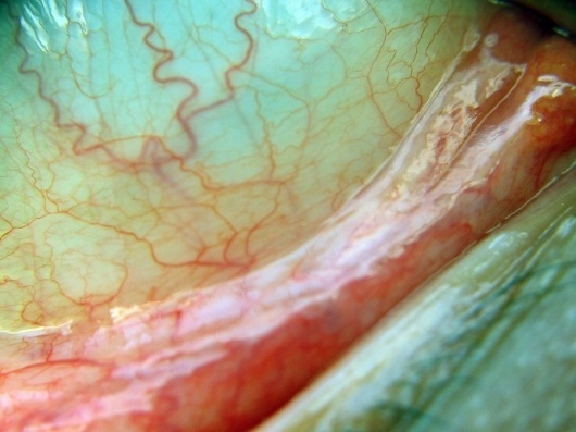 All sizes | . | Flickr - Photo Sharing! #eye #photography #vains