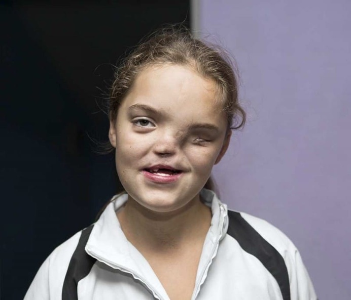 The Belarusian Victims of Chernobyl by Jadwiga BrontÄ"