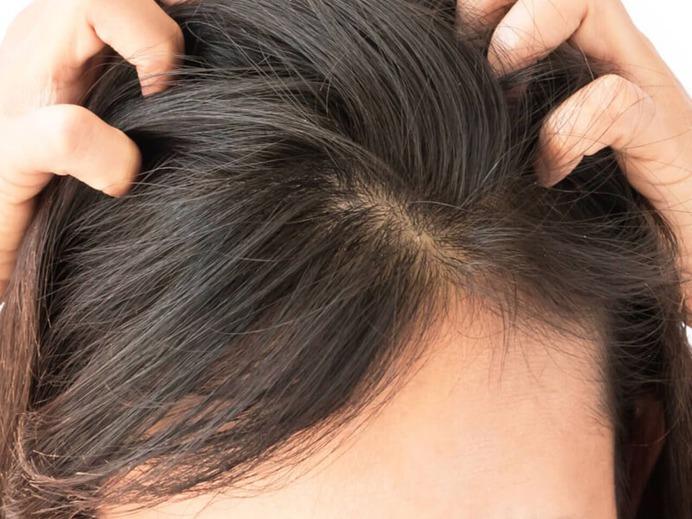 Saç derinize nasıl peeling yaparsınız?