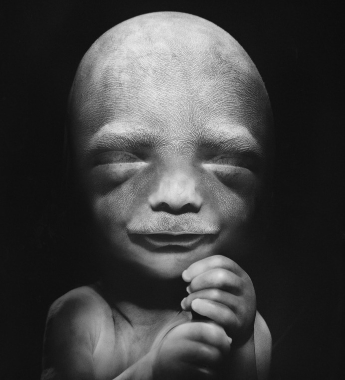 but does it float #fetus #birth #pre #face #baby