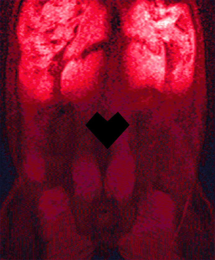 Dark & Dirty #body #guts #xray