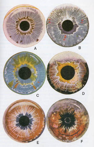Make Mistakes. #diagram #colourful #iris #eyes