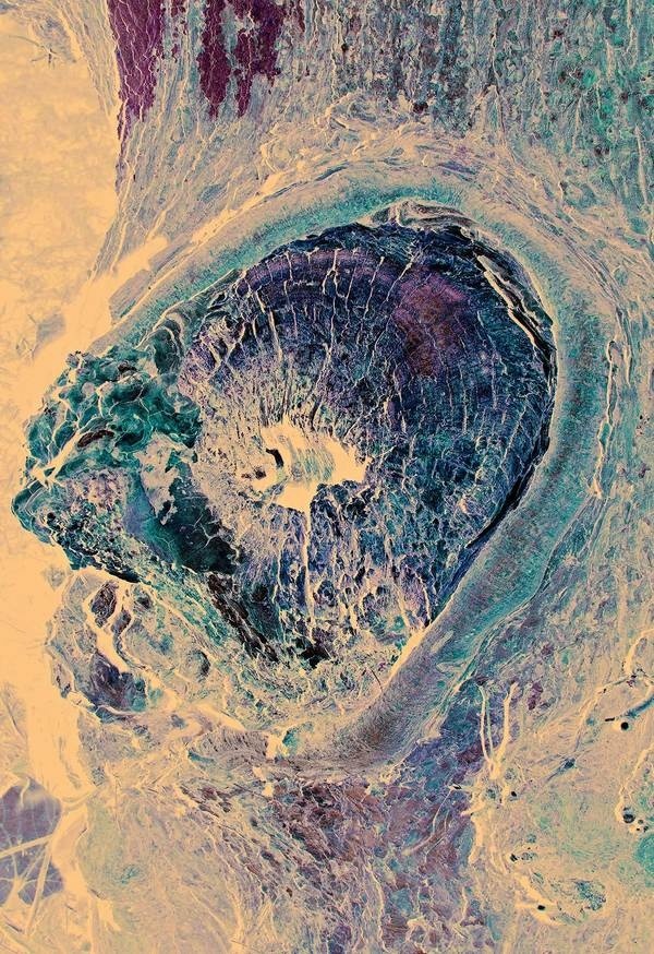 Colour of Wound I #limited #flora #edition #tree #print #body #scab #wound