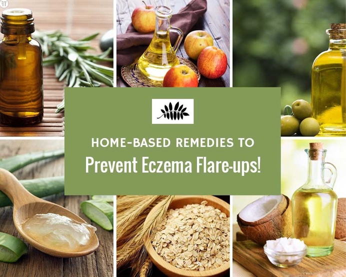 Home Remedies to Prevent Eczema Flare-ups