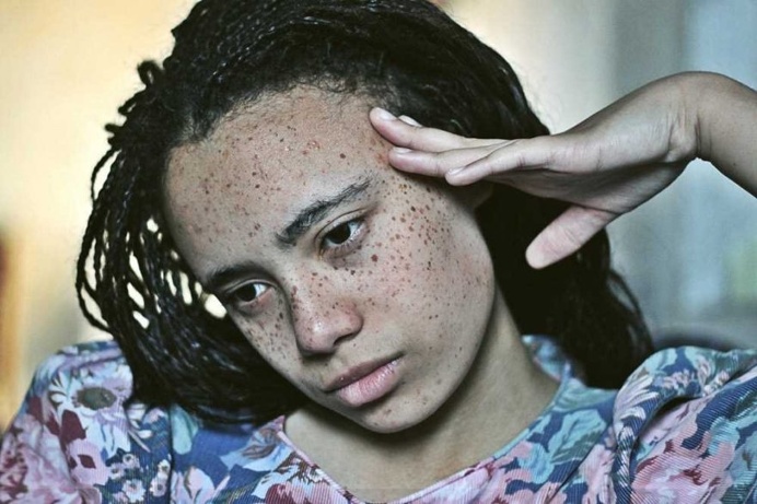 Zuzu Valla Captures The Beauty of Freckles With Striking Portraits