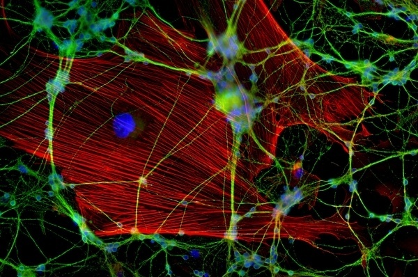 Extraordinary Microscope Photographs - The Big Picture - Boston.com #photography #microscope