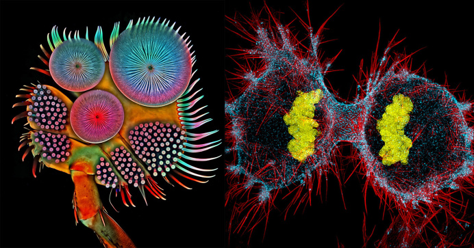 Winners Of Nikon Small World Photography Competition 2016