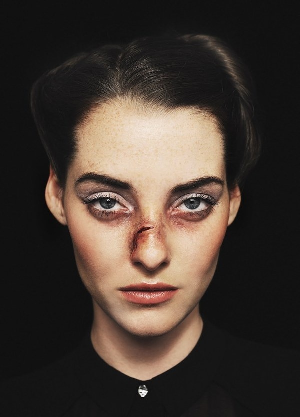 Victim of Beauty #victim #beauty