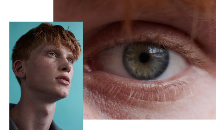 Eye