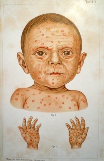 tumblrl648sazrb71qc8khq.jpg (JPEG-Grafik, 451x700 Pixel) #illustration #medicine #book