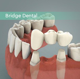 Le-Dental Dokter Gigi Tangerang – Dokter Gigi Tangerang Layanan dan perawatan gigi, lawat gigi, veneer, dokter gigi terbaik di Tangerang