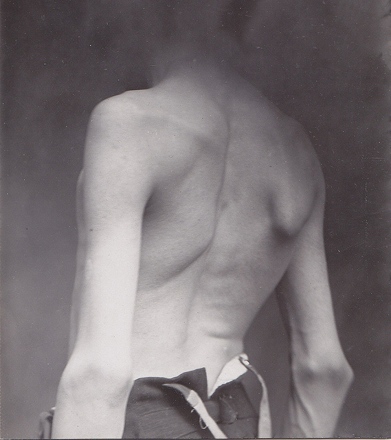 Todos os tamanhos | INTO THAT DARKNESS | Flickr – Compartilhamento de fotos! #man #back #body