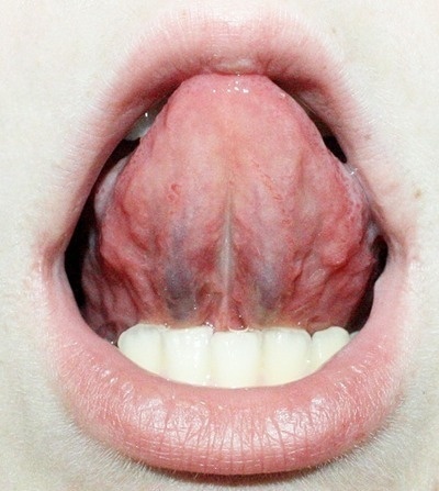 bloood #lips