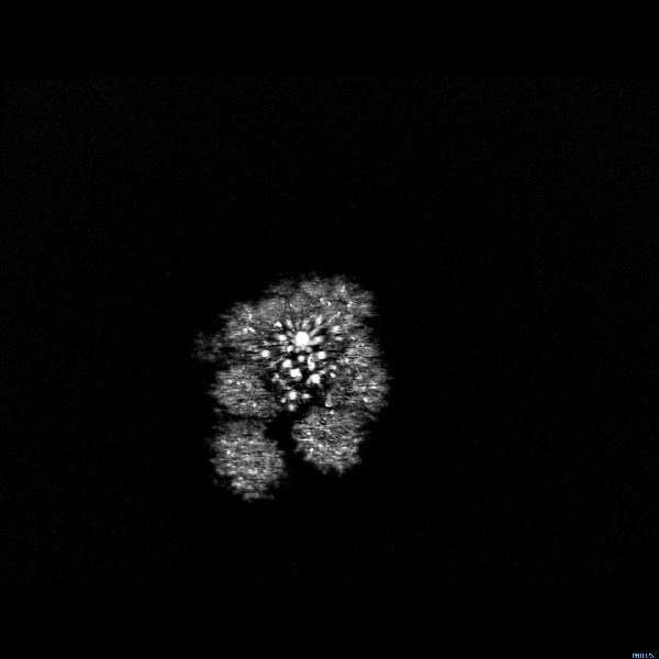 Loop, Fractal, Black and white