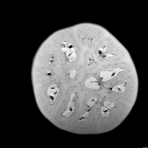 TOMATO Magnetic Resonance Imaging uses magnets to align hydrogen atoms and radio waves to create a series of images of internal structures #andy #tomato #magnetic #ellison #mri #3d