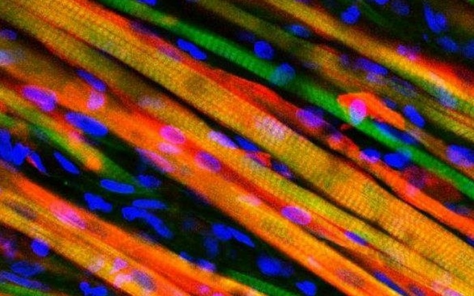 A university has developed muscles that can regenerate 10 times faster than any bioengineered muscles. It has been studied and tested on a l #modern #design #product #industrial #technology