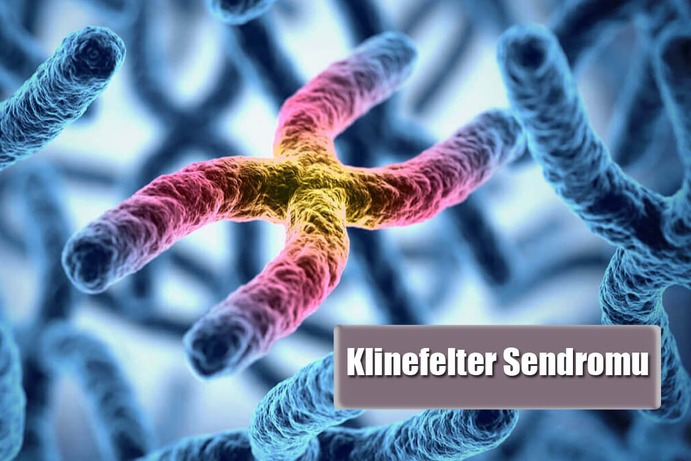 Klinefelter Sendromu Nedir? Sebepleri Nelerdir?