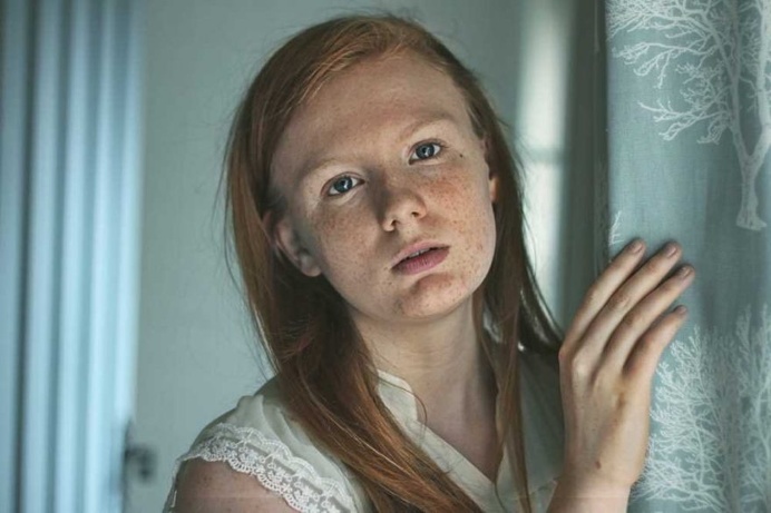 Zuzu Valla Captures The Beauty of Freckles With Striking Portraits