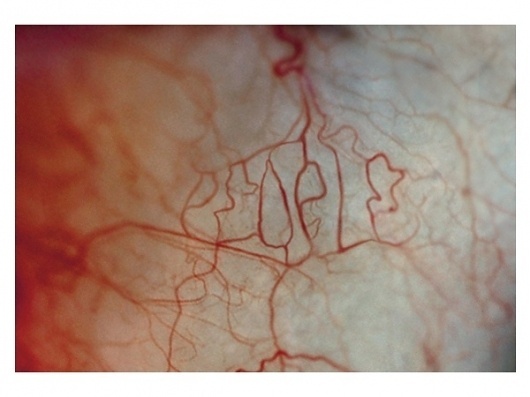 Don't judge people according to their appearance — Synaptic Stimuli #blood #vessel #typography