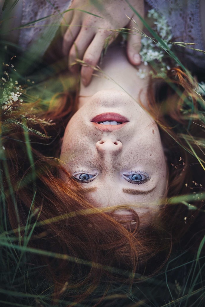 Bosnian Photographer Is Showing People The True Beauty of Freckles