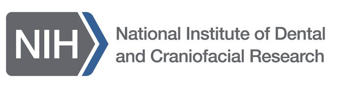 National Institute of Dental and Craniofacial Research Periodontal (gum) disease is an infection of the tissues that hold your teeth in place. It's typically caused by poor brushing and flossing habits that allow plaque—a sticky film of bacteria—to build up on the teeth and harden. In advanced stages, periodontal disease can lead to sore, bleeding gums; painful chewing problems; and even tooth loss.