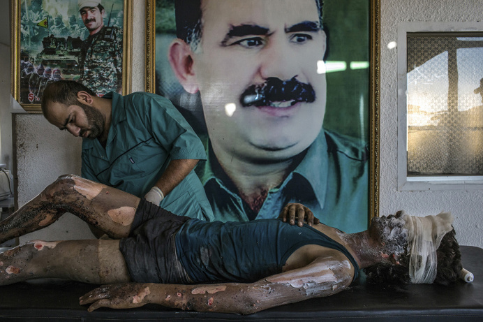 Winners of The World Press Photo 2016