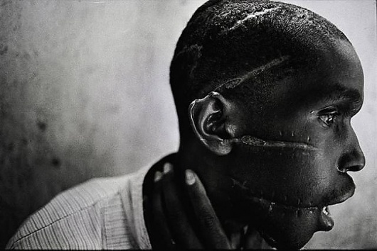 Dead Presidents - GreyHandGang™ #scars #photography