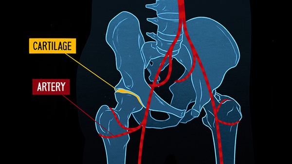 xray 1 #motion #illustration