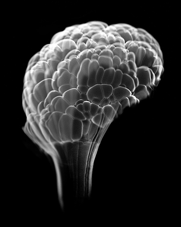 High Speed Photos of Combusting Alcohol Look like X Rays of the Human Brain #white #combustion #alcohol #anatomy #black #brain #ray #photography #fire #and
