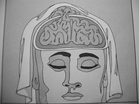 The Sid - tonkunst #injured #damage #brain #accident #medical #grey