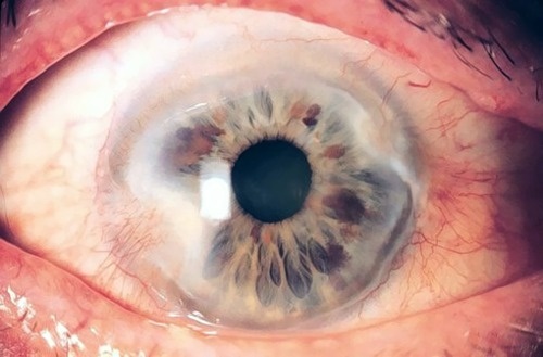 YIMMY'S YAYO™ #eye